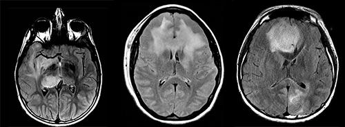3 MRI Scans 3 MRI Scans